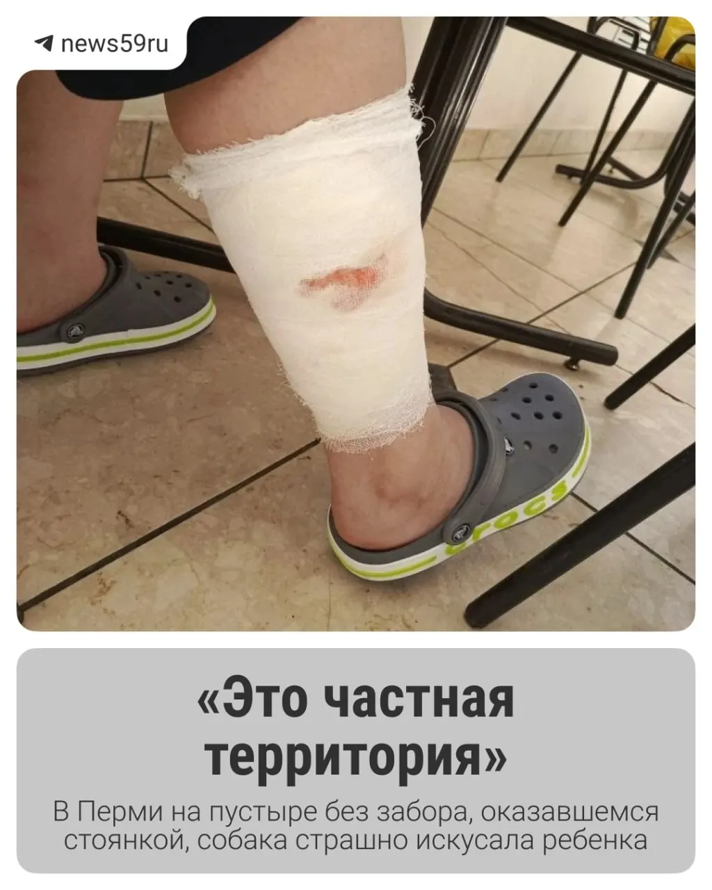 На неогороженной стоянке рядом с магазином сторожевая собака серьёзно покусала мальчика: ребёнка госпитализировали, мать обратилась в полицию.