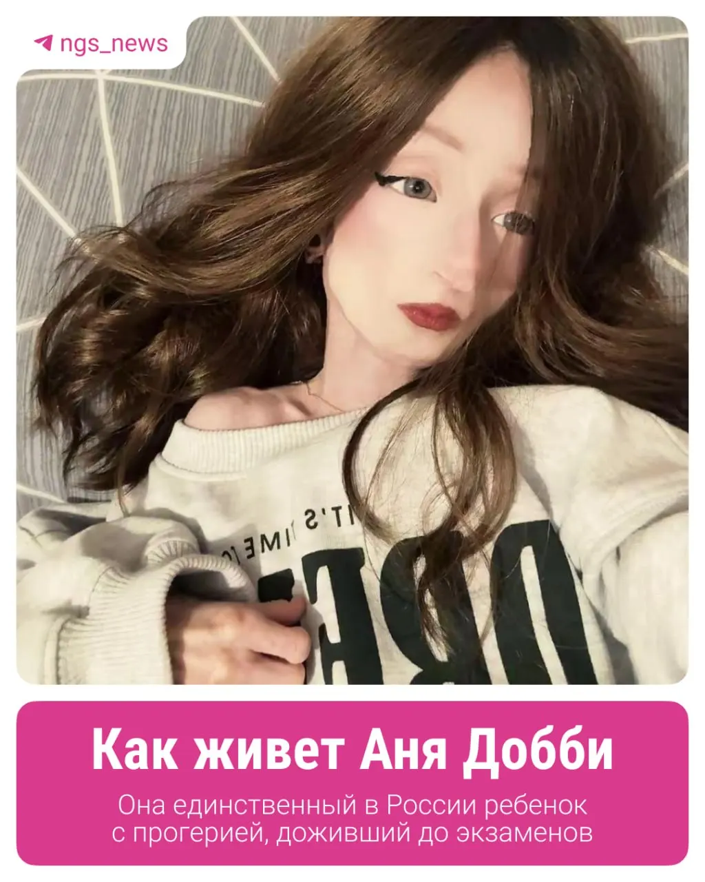 Ане почти 17 лет. Несмотря на редкое генетическое заболевание — прогерию — она готовится к экзаменам. Отец сообщает, что семья ждёт приглашения на участие в зарубежных клинических испытаниях и одновременно добивается получения школьного аттестата.