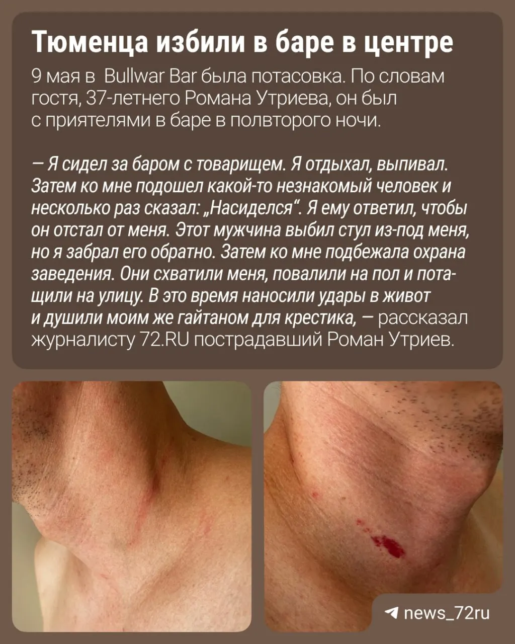 Посетитель утверждает, что конфликт из‑за стула перерос в потасовку, его вывели из заведения. По факту подано заявление — городское УМВД проводит проверку.