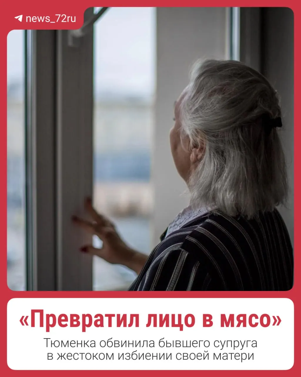 Пенсионерка из ХМАО приехала в Тобольск на несколько дней — вместо семейной встречи оказалась в больнице с раздробленным носом. Родственники обвиняют друг друга, полиция проводит проверку.