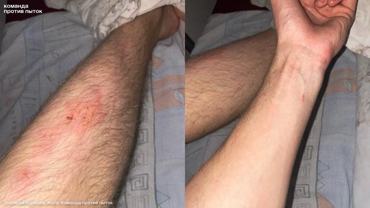 По словам молодого человека, полицейский избил его в кабинете после того, как он пришёл заявить о краже пауэрбанка; в больнице зафиксировали ссадины, гематомы и закрытую черепно‑мозговую травму. По факту инцидента проводится проверка.