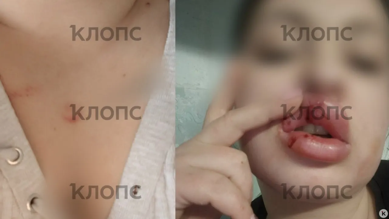Полиция возбудила уголовное дело по ч. 1 ст. 119 УК РФ. Пострадавшая прошла экспертизу шрамов, ей и адвокату вскоре могут дать доступ к материалам дела.