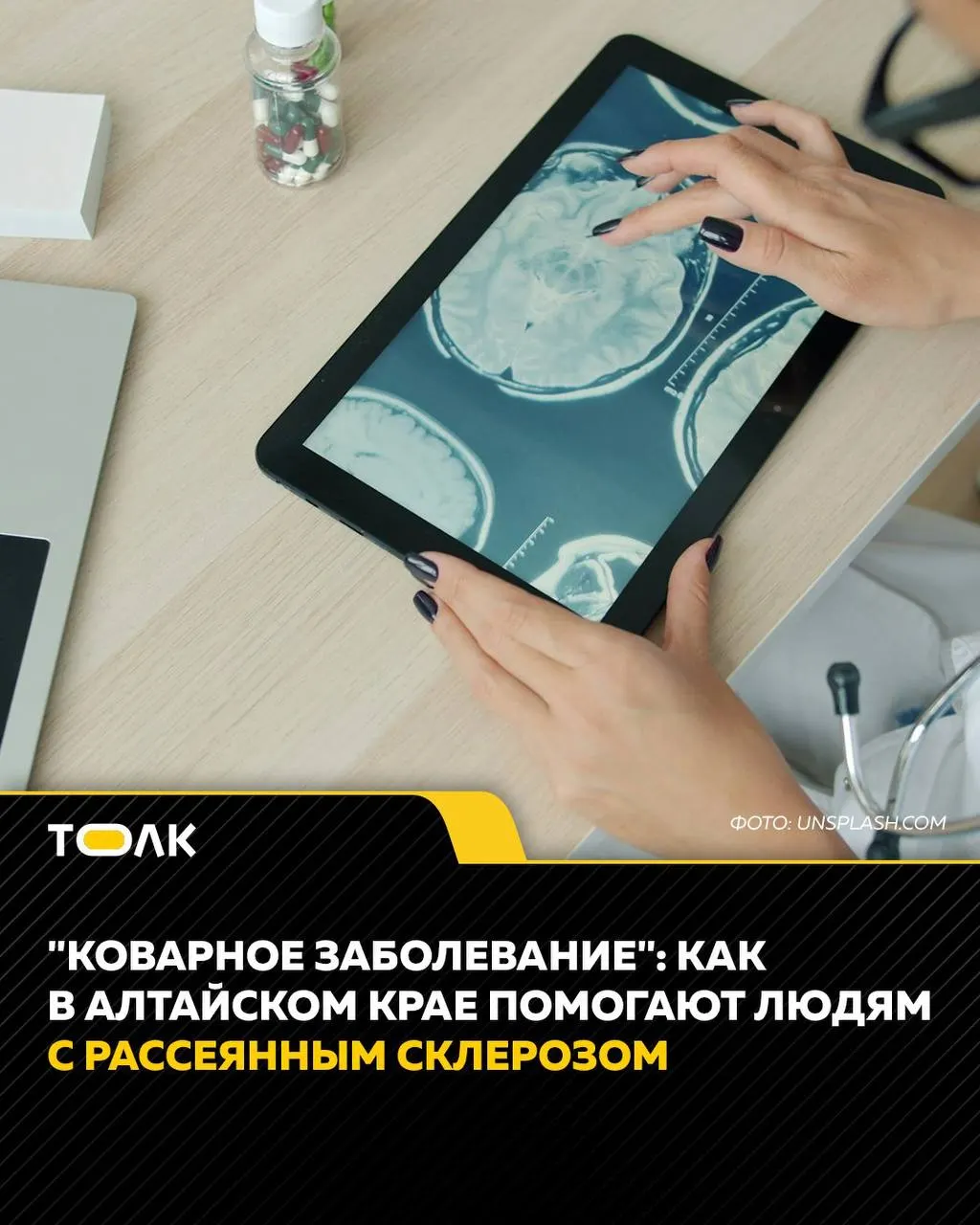 Невролог объясняет, почему болезнь проявляется по‑разному, как её путают с инсультом и как работает Школа рассеянного склероза при краевой больнице.