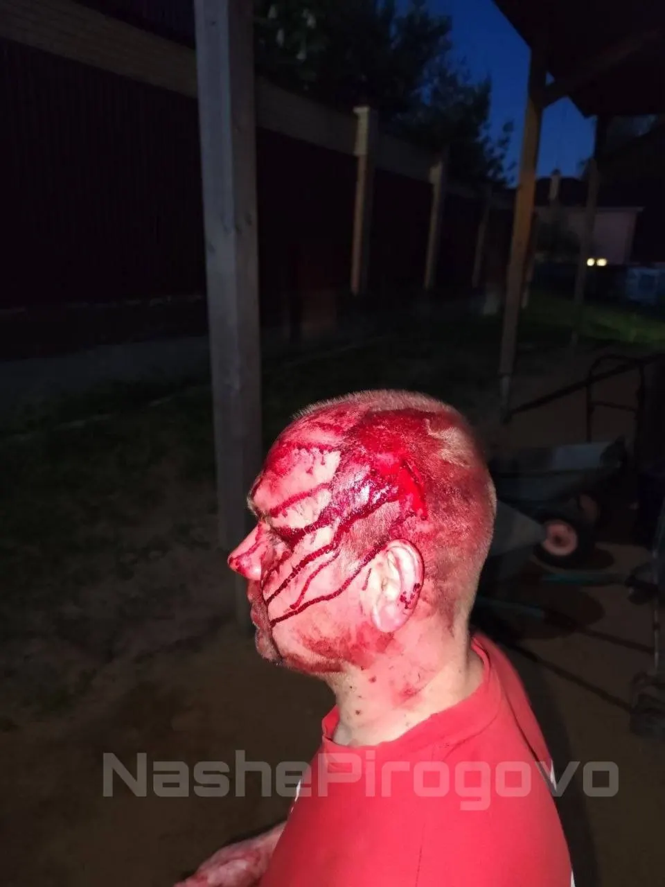 В деревне Пирогово директор местного завода напал на соседа — общественного активиста: погибла охранная собака, пострадавший госпитализирован. Жители требуют ареста и контроля со стороны следствия.