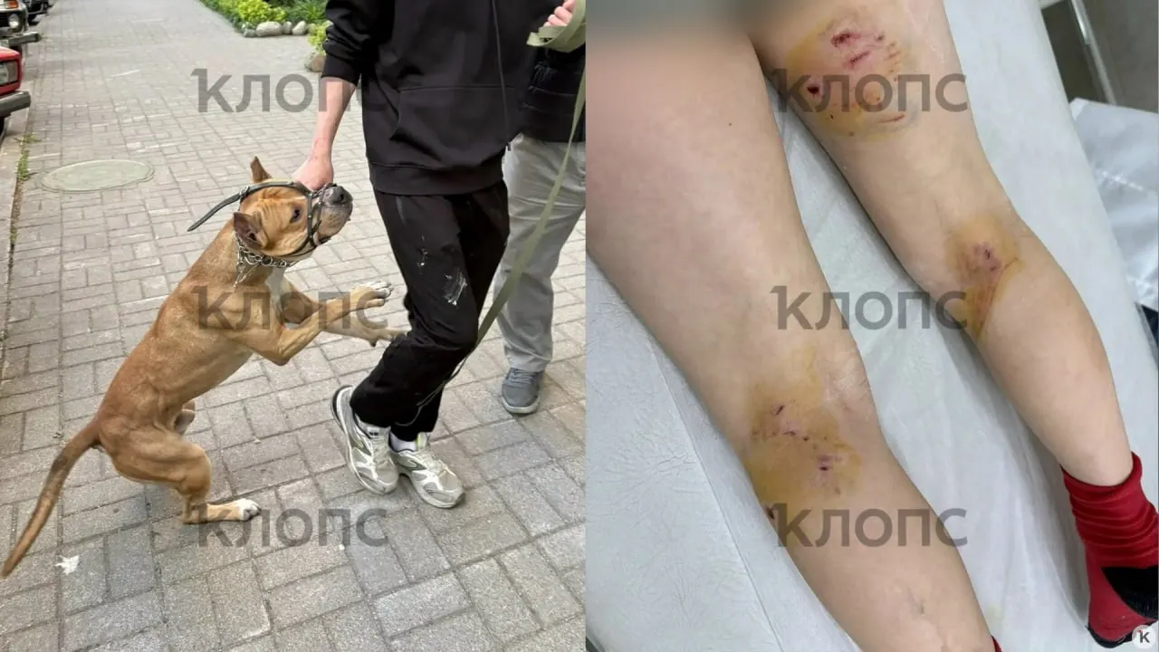 Во дворе дома стаффордширский терьер без поводка набросился на двух девятилетних мальчиков. Дети получили рваные и укушенные раны, им наложили швы и начали профилактику бешенства; хозяйка собаки скрылась и не предоставила контактов.