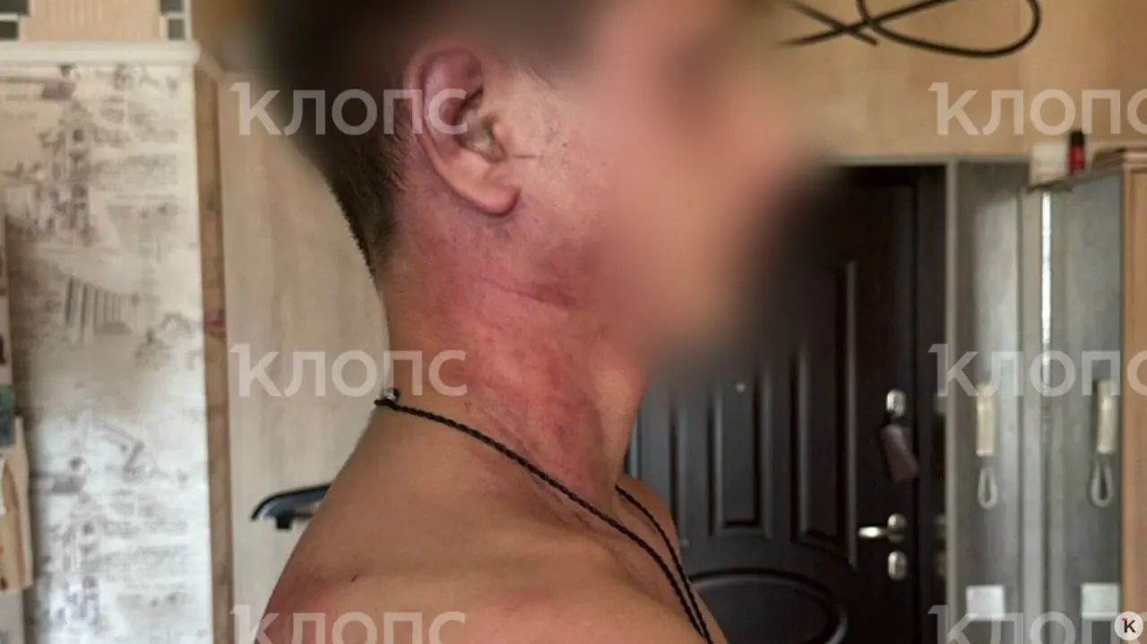 Мужчина в Калининграде жестоко напал на 14‑летнего сына, который жил с ним после развода. Ребёнка душили, били по лицу, сейчас ему поступают угрозы; мать связывает нападение со спором об опеке.