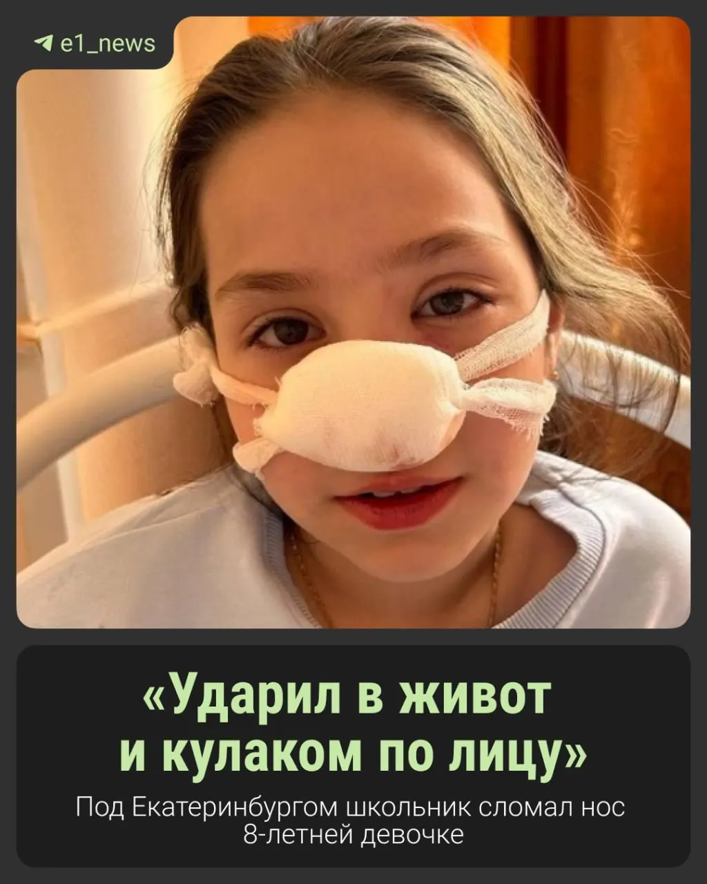 Драка на детской площадке: девочка провела неделю в больнице, родители конфликтующих детей дают разные версии произошедшего.