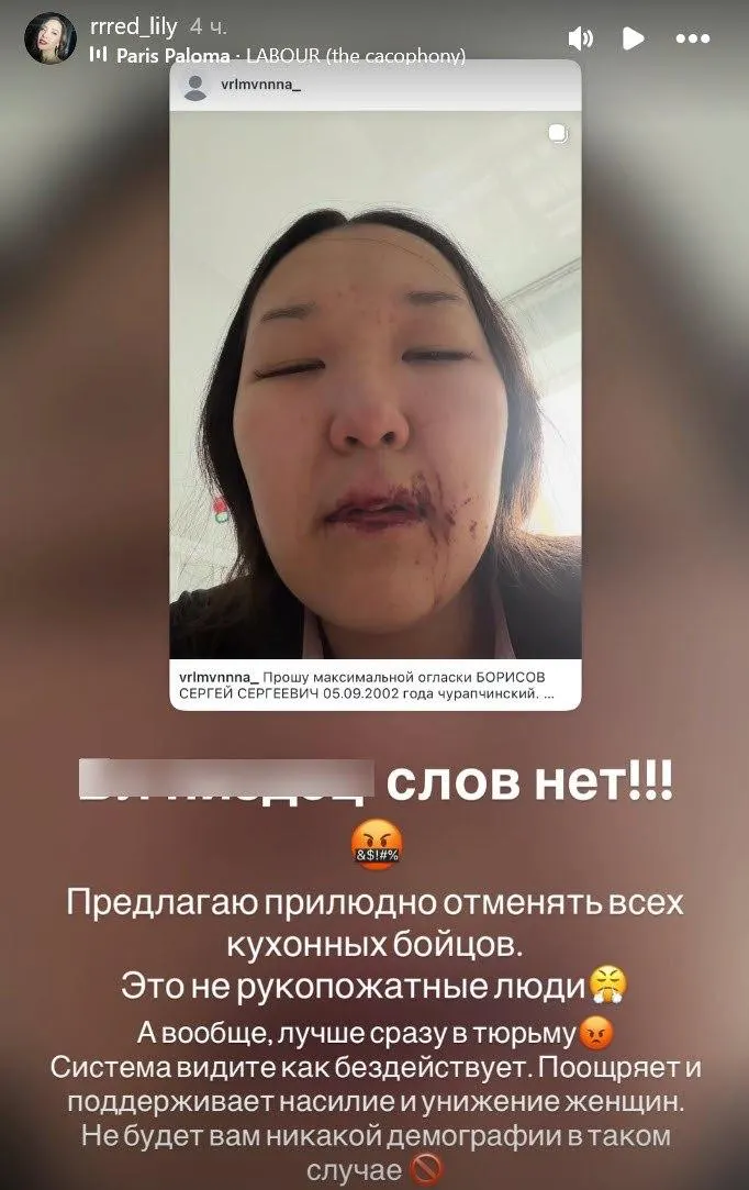 Жительница Якутска опубликовала фото и видео с признаками побоев и утверждает, что бывший партнёр систематически её избивал. Женщина подала несколько заявлений в полицию, но, по её словам, правоохранители не принимают мер.