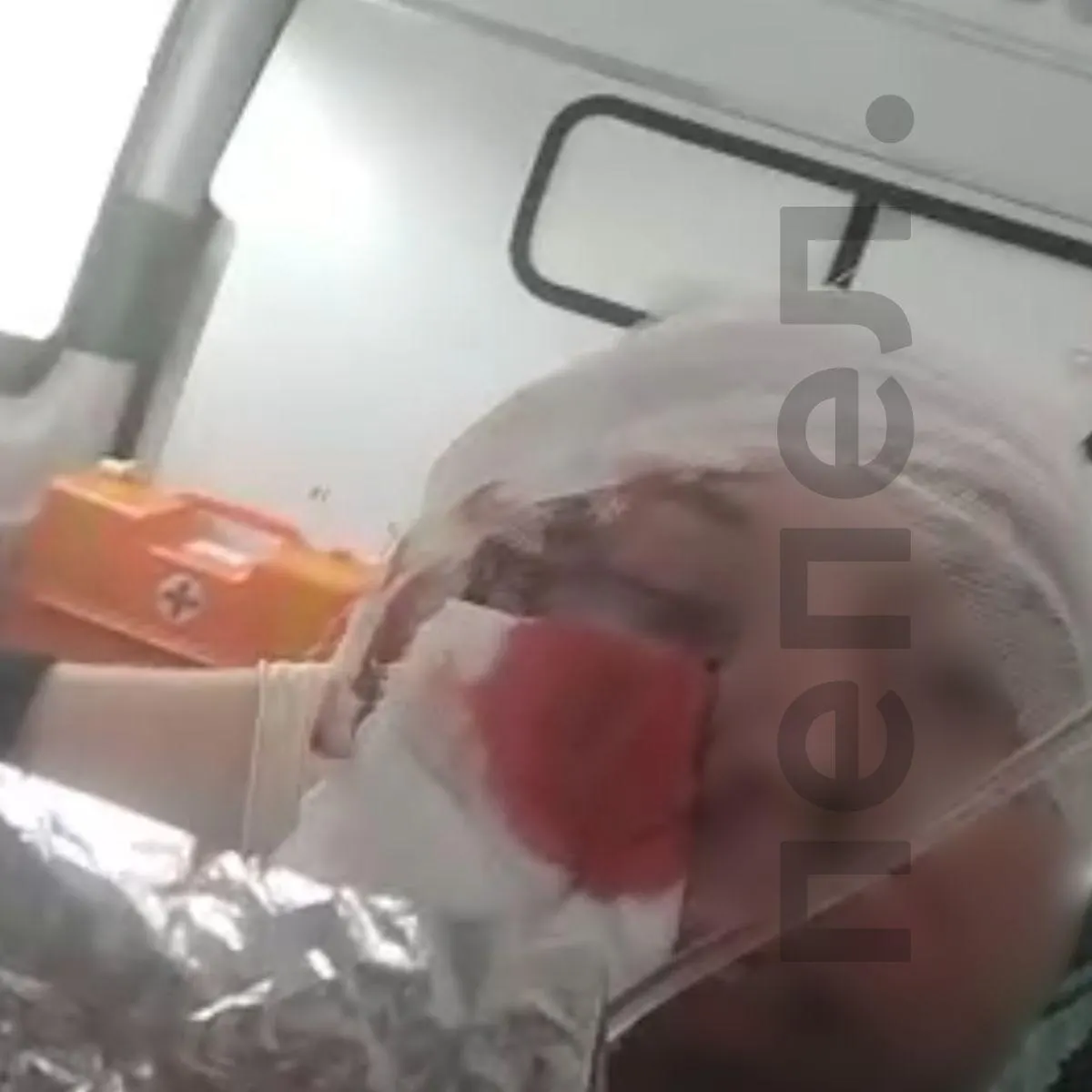 Бывший начальник караула, получивший ранения при обстреле части, рассказал, что руководству присвоили статус ветеранов боевых действий, тогда как обычные пожарные не получили приграничных надбавок, компенсаций и поддержки.