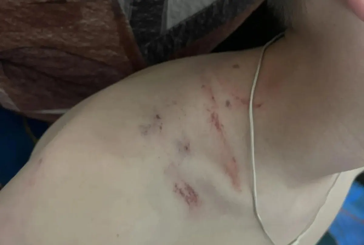 В закрытом поселке ЗАТО Горный мужчина ударил школьника, который взял велосипед у подъезда; у ребёнка зафиксированы ушибы, полиция подтвердила факт инцидента, проверка продолжается.