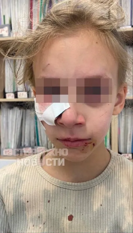 Пес напал на восьмилетнюю ученицу во время работы пришкольного лагеря. Ребёнку сделали операцию, полиция начала проверку; отец утверждает, что помощь вызвали не сразу.