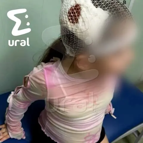 В Екатеринбурге пятилетняя девочка получила серьёзные травмы: на неё упал шкаф, в больнице диагностировали переломы позвоночника в четырёх местах.