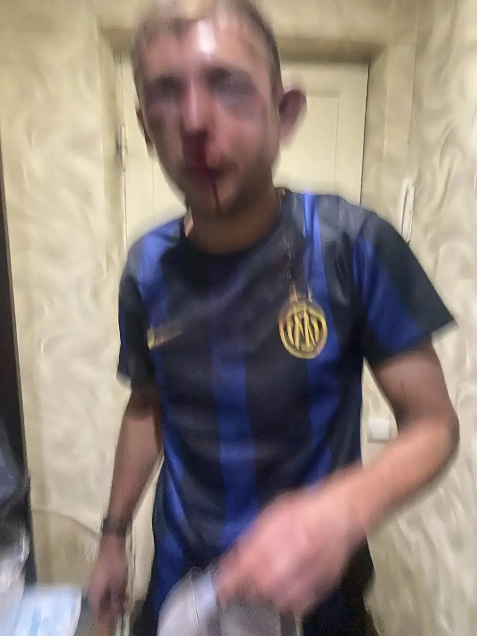 33‑летний Дмитрий Чавкин попал в больницу с сотрясением, несколькими переломами челюсти и ушибом почки после нападения компании мужчин на пляже; очевидцы, по словам родственников, не вмешались.