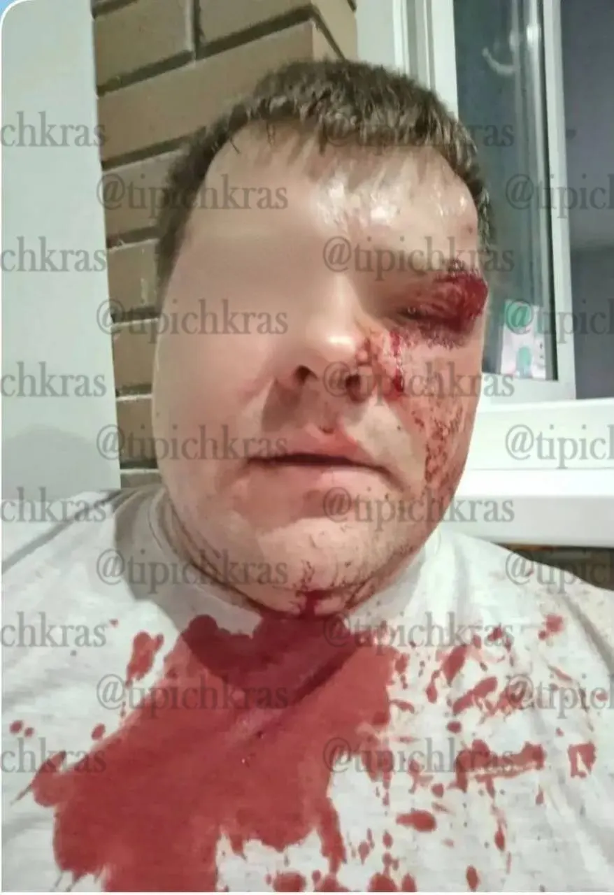 В жилом комплексе «Зеленоград» в поселке Северном компания подростков и молодых людей избила мужчину после замечания на детской площадке; подробности приводит жена пострадавшего.