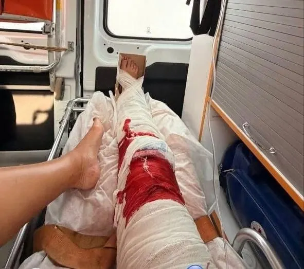 Утром 12 июня певица получила травму в домашних условиях и была госпитализирована. Перелома нет, но травма серьёзная; концерт в Ростове, намеченный на 13 июня, пока остаётся под вопросом.