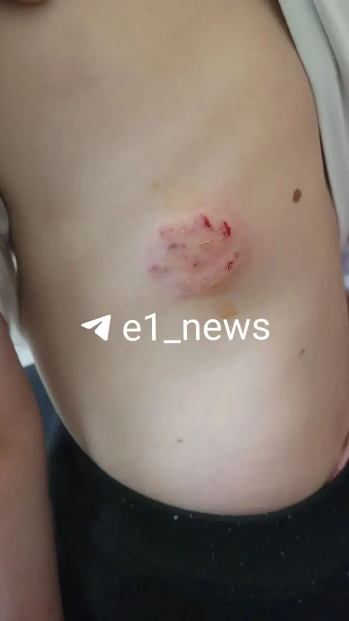 В Октябрьском районе собака без намордника напала на ребёнка на площадке. Родители написали заявление в полицию, девочке назначили курс уколов; просят владельца предоставить информацию о прививках.
