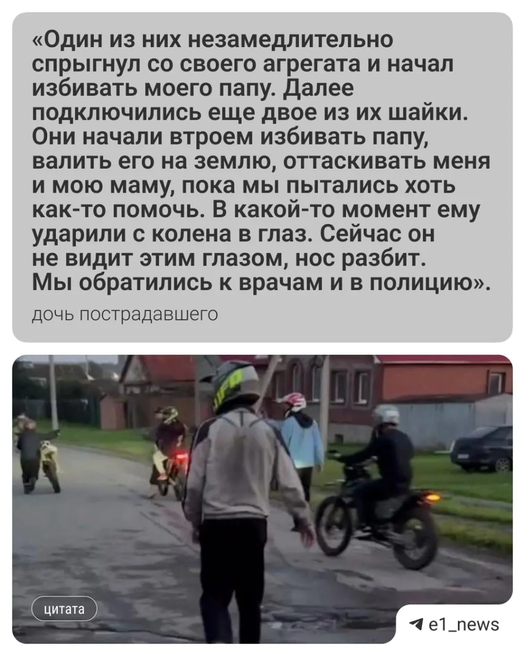 В селе Белоярского округа группа подростков на питбайках напала на 52-летнего мужчину, сделавшего им замечание из‑за шума; пострадавший получил серьёзные травмы лица, родственники жалуются на отсутствие следственных действий.
