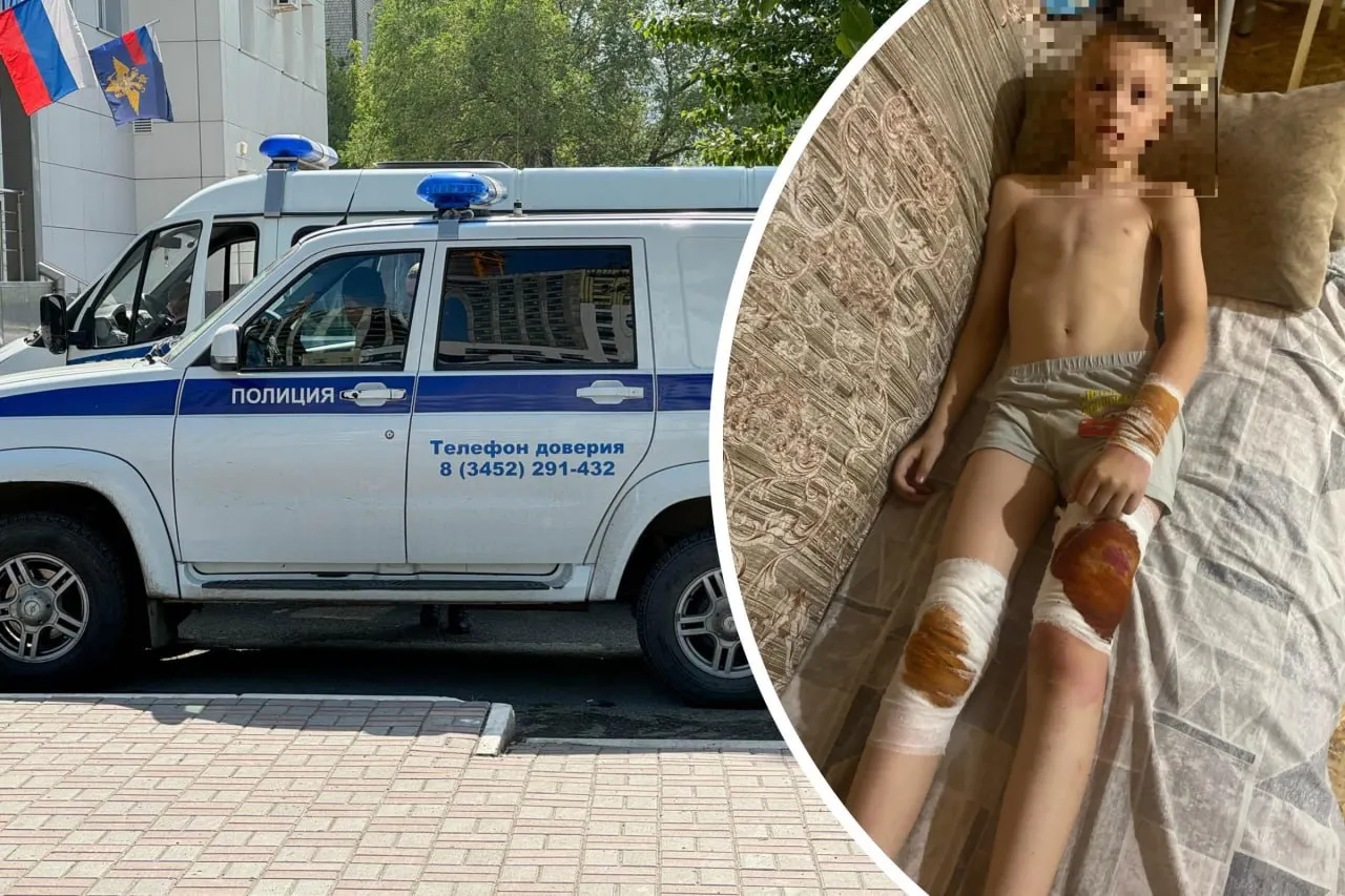В одном из тюменских СНТ бойцовская собака сорвалась с поводка и покусала ребёнка. По словам местных жителей, хозяева питомника не оказали помощи, ранее по этой собаке уже поступали жалобы в полицию.