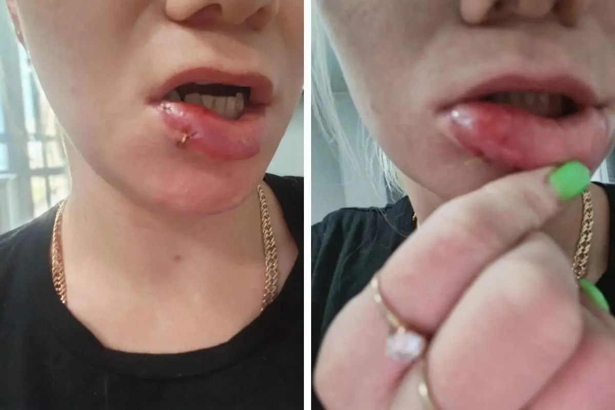 Вечером женщина пела в квартире, сосед сверху пришёл и, по её словам, ударил её в лицо; пострадавшей наложили четыре шва.