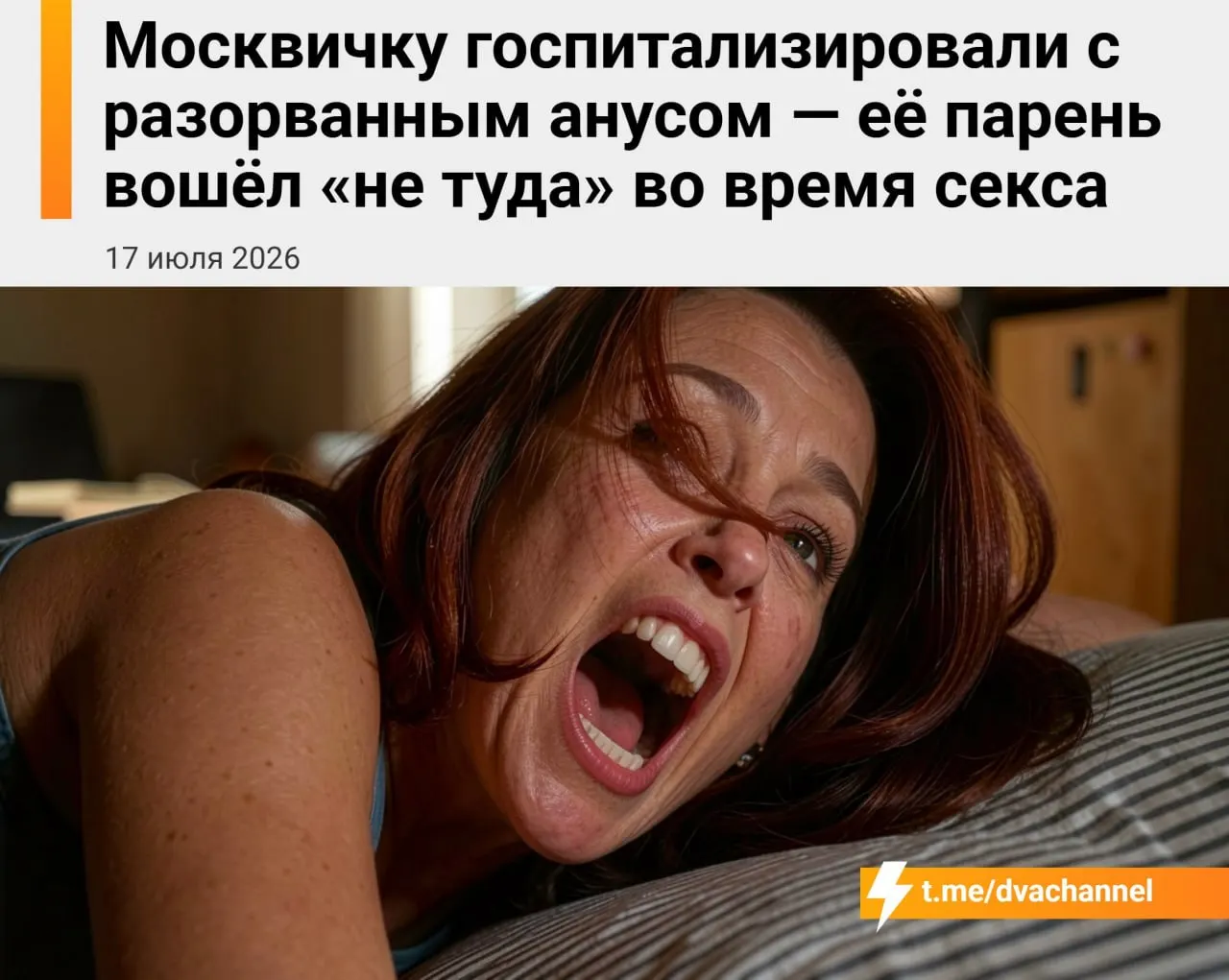20-летнюю девушку экстренно прооперировали: у неё диагностировали разрыв кишечника и сильный отёк тканей после случайного проникновения во время секса.