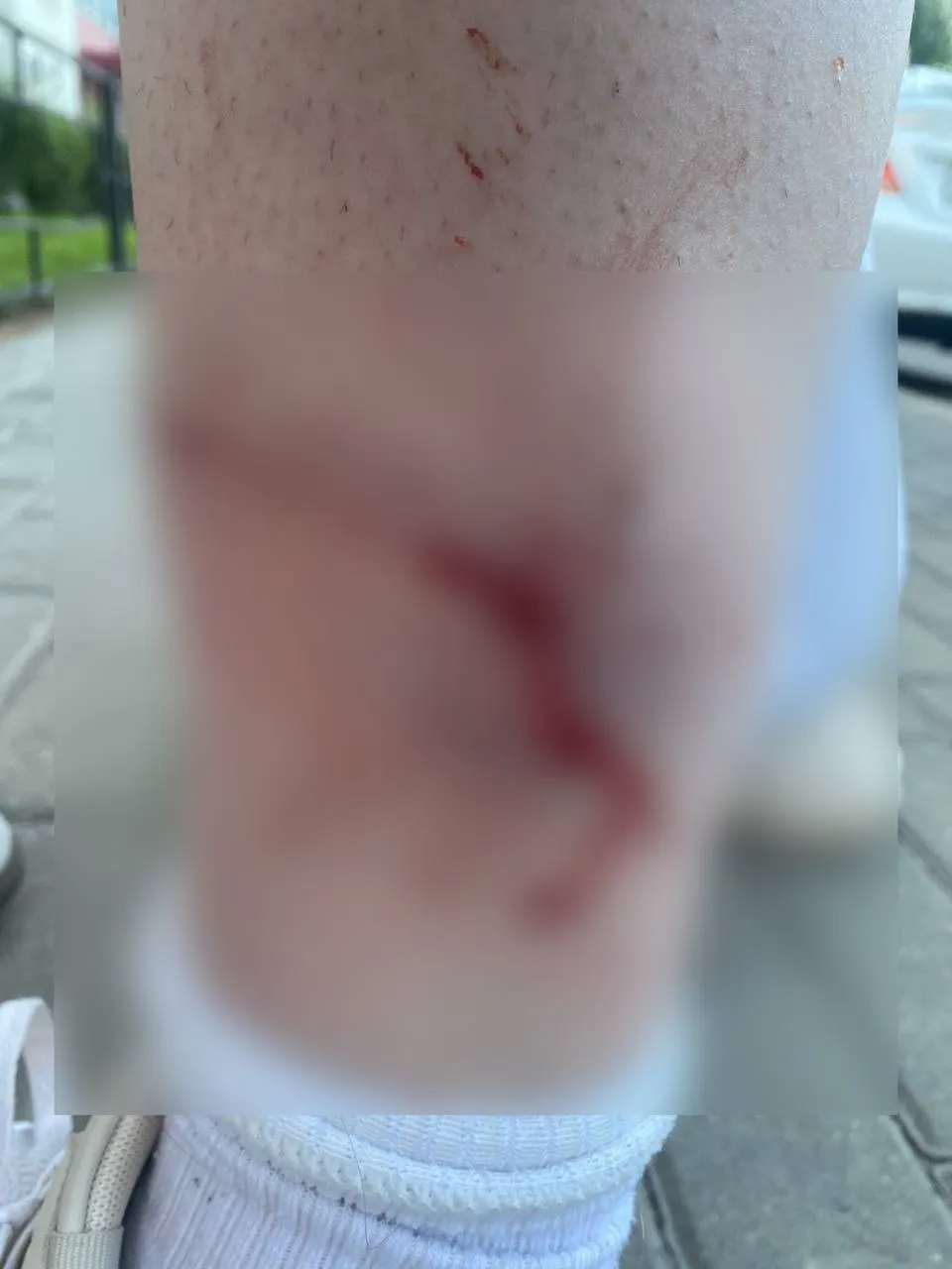 Вечером 24 июля на Олимпийском бульваре во Воронеже несколько крупных собак напали на двух девушек. Обе получили укусы ног, одна из пострадавших потребовала наложения швов; девушки обратились в полицию и намерены добиваться ответственности владельца животных.