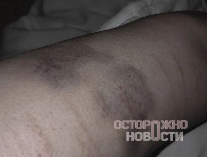 Один из находившихся в автозаке сообщил, что сотрудник ОМОНа избил нескольких задержанных, применял электрошокер и оскорблял людей; некоторым не предъявили обвинений.