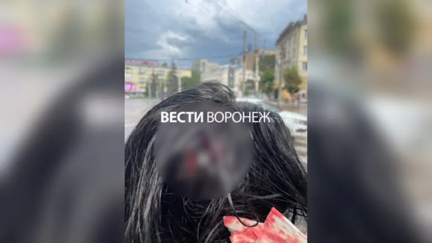 10 июля с фасада дома на Кольцовской во время непогоды упала лепнина: осколок попал в голову девушке, ей поставили сотрясение мозга. Пострадавшая собирается требовать возмещения через суд, управляющая компания пока молчит.