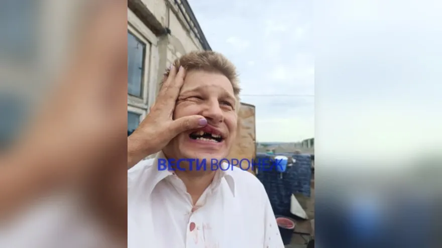 Ранним утром 8 июля у факультета журналистики ВГУ неизвестный напал на мужчину с инвалидностью. Пострадавший получил многочисленные травмы, прокуратура инициировала проверку и помогает в розыске нападавшего.