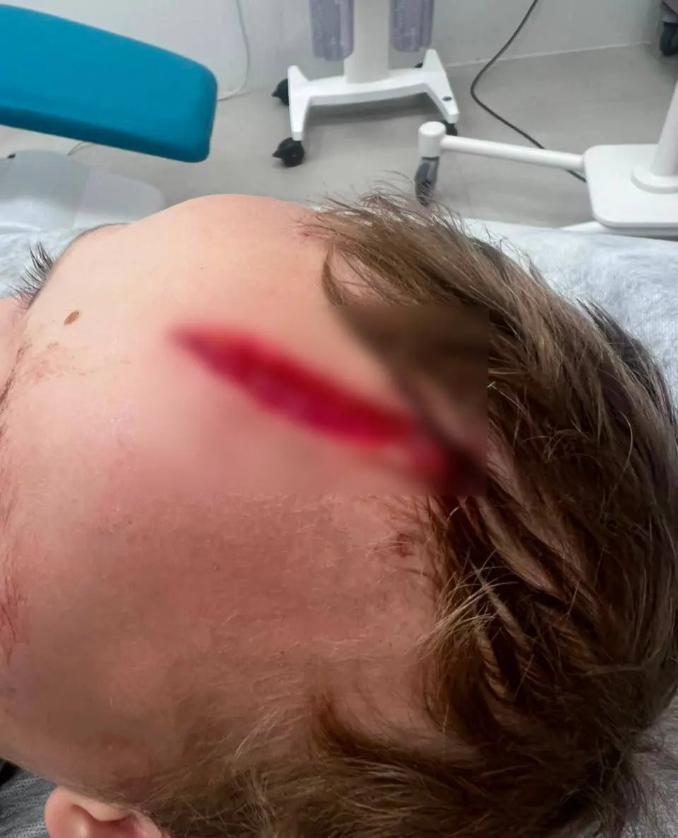 В деревне Дубцы (Одинцовский район) семилетнего внука Дарьи Донцовой укусила собака. Мальчик доставлен в клинику Рошаля; свидетели говорят, что хозяин пса лишь наблюдал за нападением.