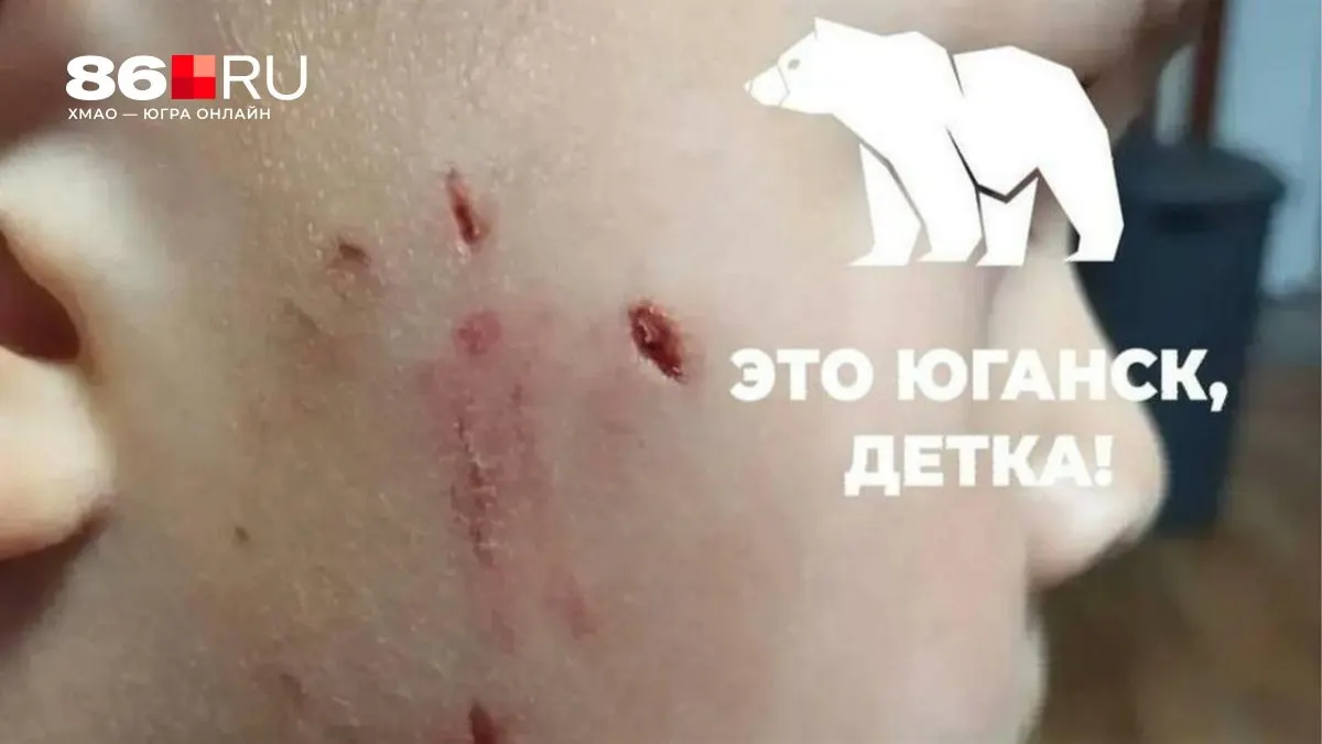 Малыш заявил, что собака «была с тётей». Правоохранительные органы проводят проверку по факту инцидента.