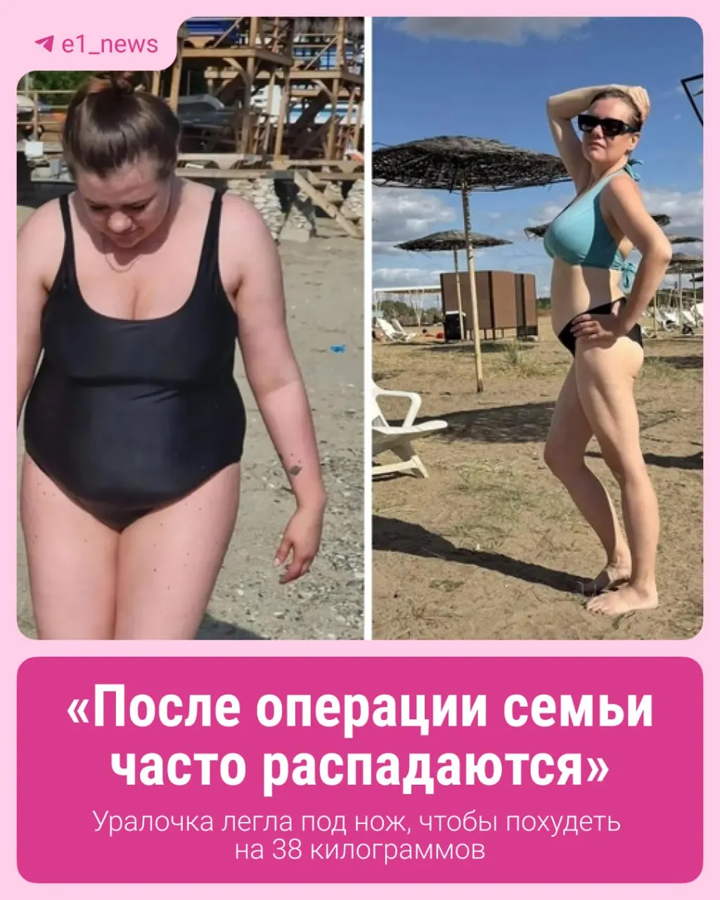 32-летняя женщина из Ревды за полгода похудела почти на 40 кг после бариатрической операции и объясняет, что это не волшебство, а первый шаг к здоровью.
