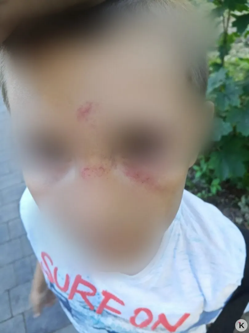 Инцидент произошёл на детской площадке. Мальчик получил синяки, мать обратилась за медицинской помощью и в полицию, проводится проверка.