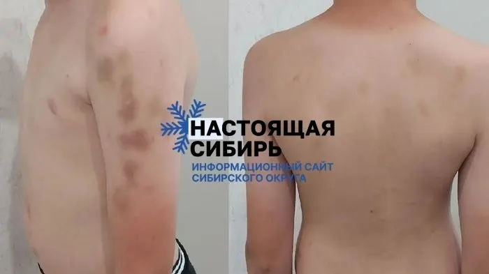 В омском военно-патриотическом лагере зафиксировано жестокое обращение к несовершеннолетнему, что привело к тяжёлым травмам и возбуждению уголовного дела.