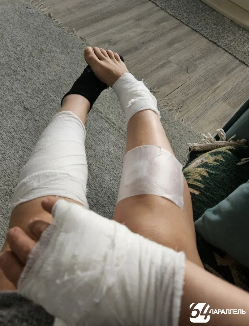 Пострадавшая получила ранения во дворе дачного домика; владельца собаки оштрафовали, женщина подала иск о возмещении ущерба.