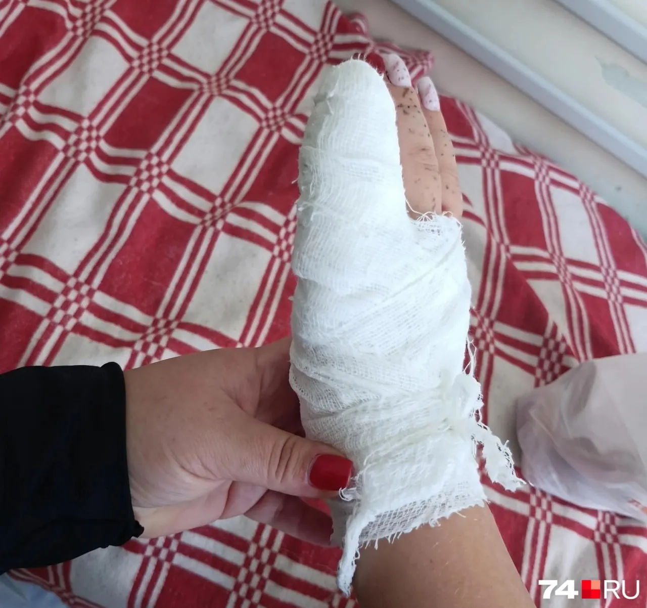 10-летняя девочка пострадала на детской площадке в Ленинском районе: кончик пальца зажат между рукояткой и тренажёром. Её прооперировали, ведётся расследование произошедшего и безопасность оборудования оценивается.