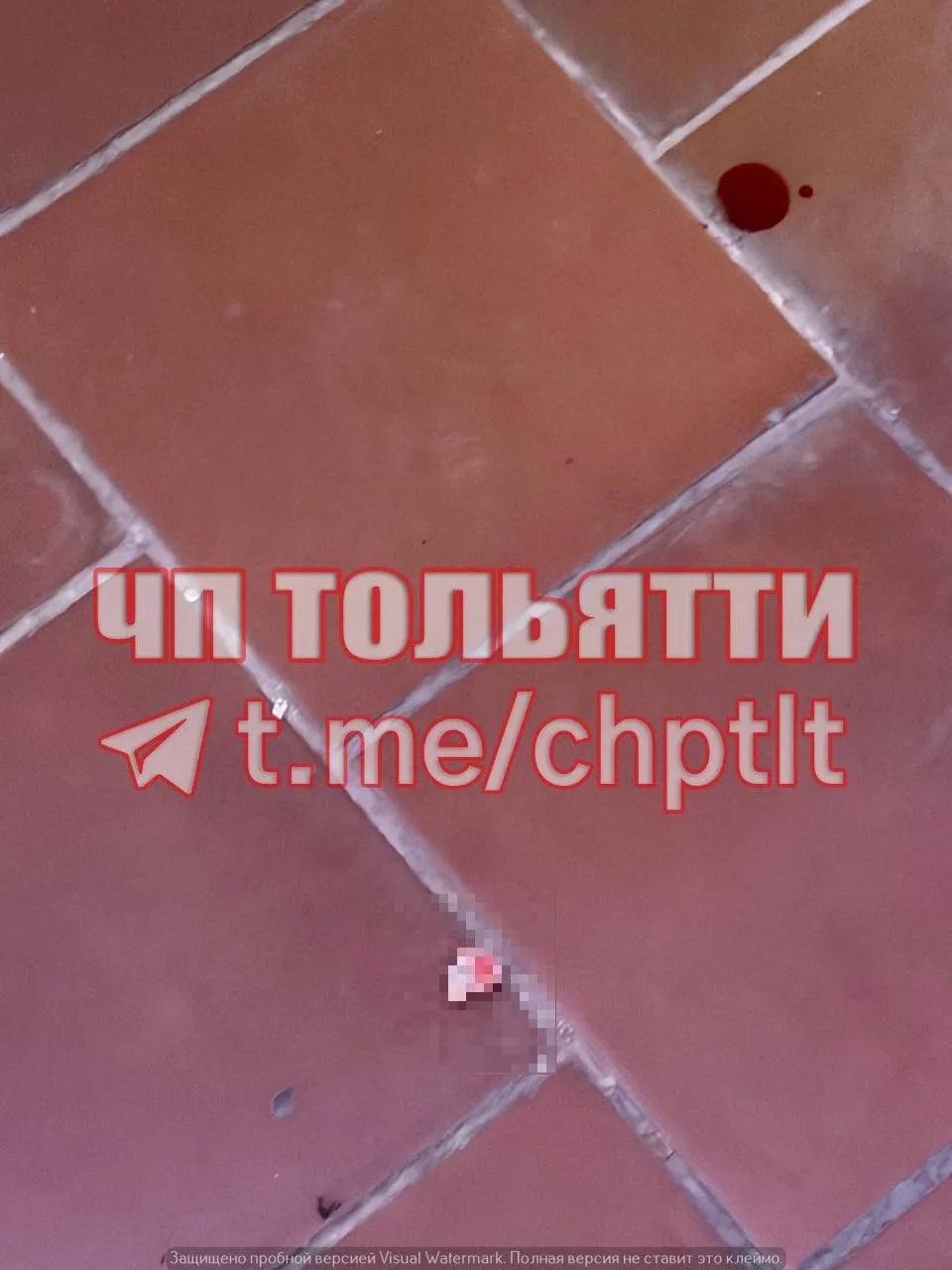 Очевидцы сообщили, что палец девочки зажат дверью во время занятия.