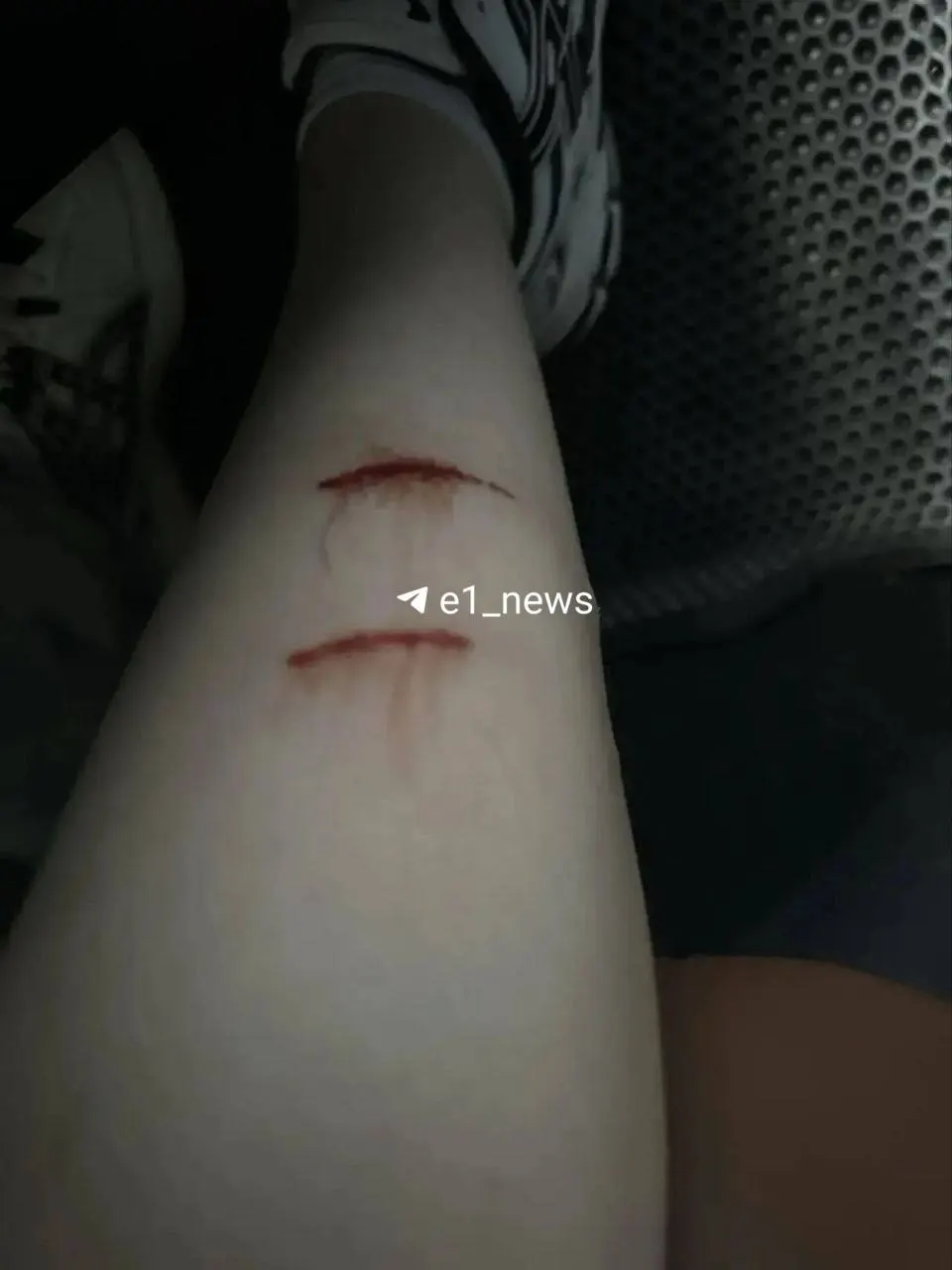 16-летняя девушка пострадала после нападения стаи бездомных собак на улице Европейской в Екатеринбурге; пострадавшая получила прививку и была доставлена в больницу.