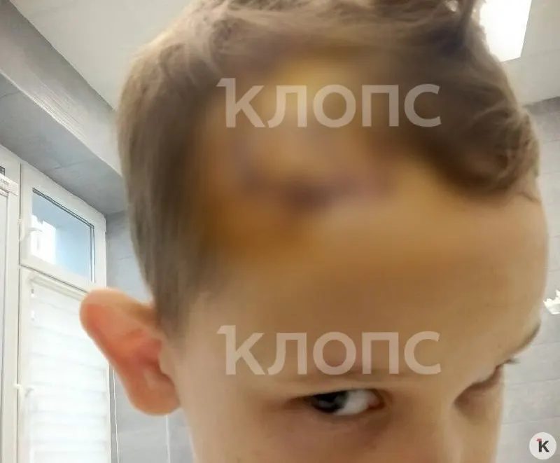 Родители описывают травмы и реабилитацию ребенка, а также попытки получить финансовую помощь от водителя, который отказался её предоставить.