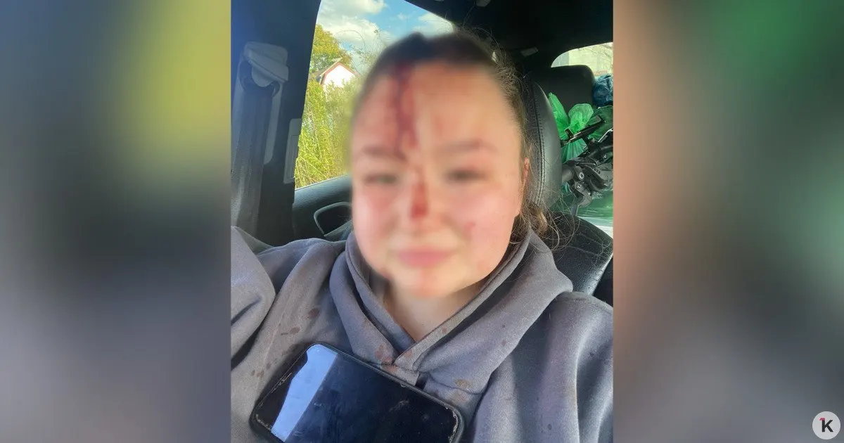 22-летняя калининградка получила травму головы во время конфликта между родственниками её дяди, который забирал вещи после развода; нападавшими оказались тёща и тесть.
