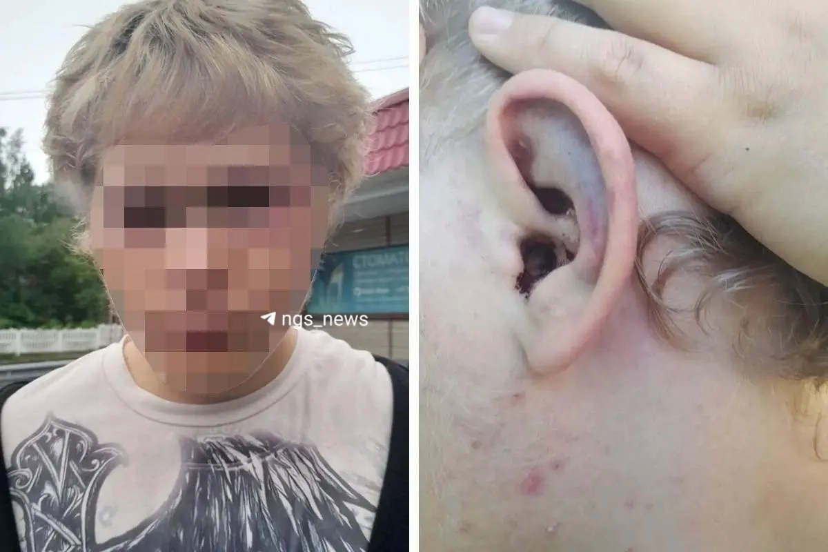 Ночью в поселке Горный компания подростков напала на несовершеннолетнего, после чего пострадавший был госпитализирован. Правоохранительные органы устанавливают виновников.